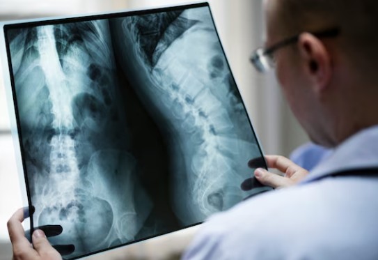 Radiografia da coluna
