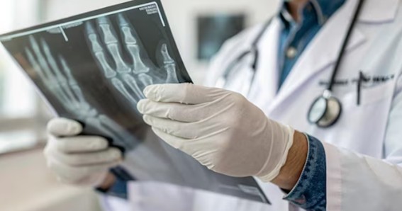Radiografia da mão